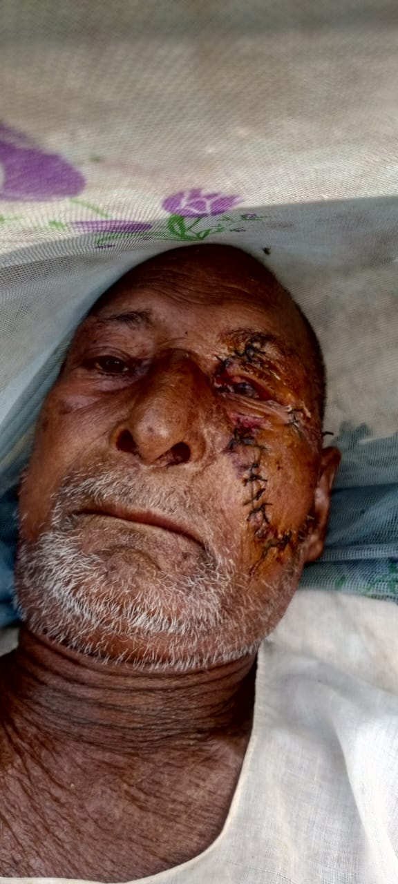 बंदरों के आतंक से कस्बावासियों में भय का माहौल हो रहे परेशान